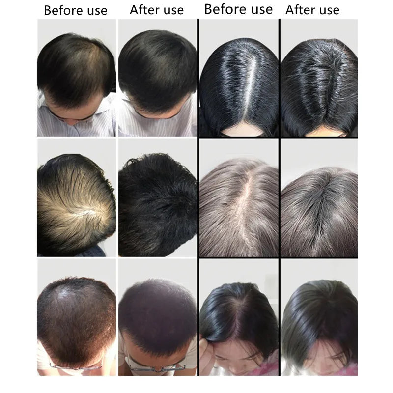 9-Color Keratin Hair Fibers – Instant Hair Thickening